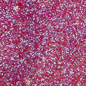 Derivan Kindy Glitz Hot Pink  - Glitter Glue